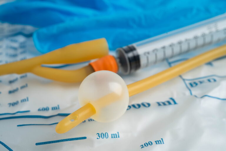 A Foley urinary catheter with inflated balloon and drainage bag used in medical management of urinary incontinence.